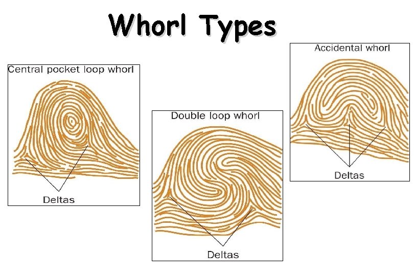 Whorl Types * 