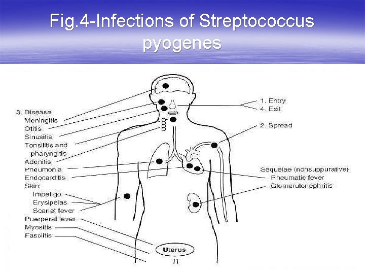 Fig. 4 -Infections of Streptococcus pyogenes 