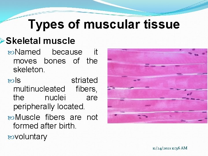 Types of muscular tissue ØSkeletal muscle Named because it moves bones of the skeleton.