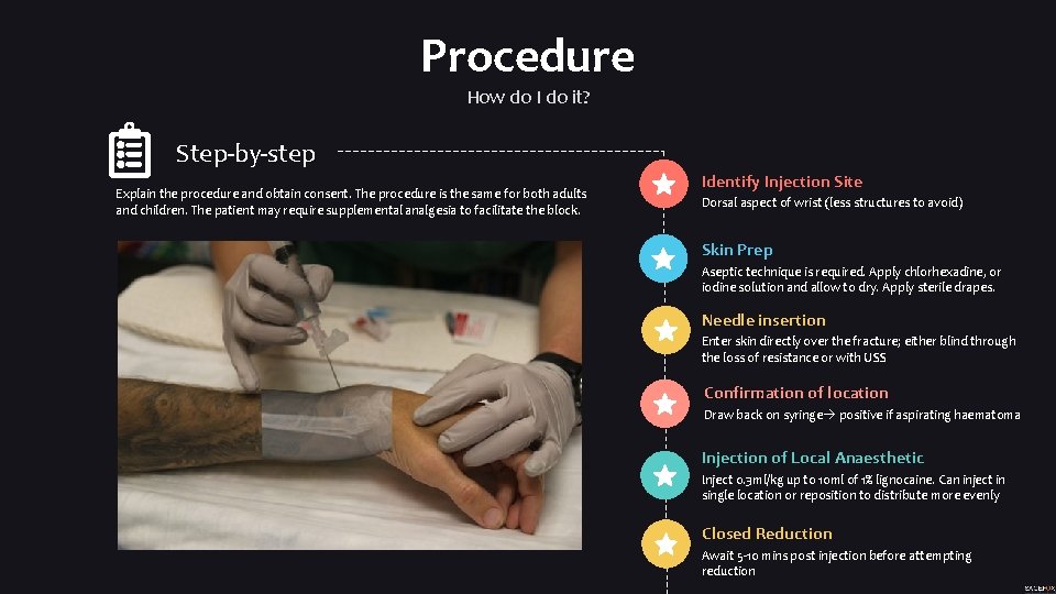 Procedure How do I do it? Step-by-step Explain the procedure and obtain consent. The