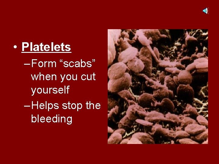  • Platelets – Form “scabs” when you cut yourself – Helps stop the
