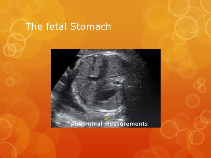 The fetal Stomach 