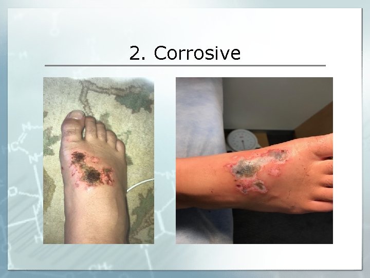 2. Corrosive 