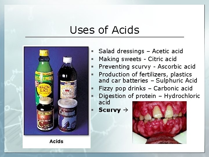 Uses of Acids Salad dressings – Acetic acid Making sweets - Citric acid Preventing