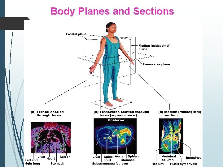 Body Planes and Sections 