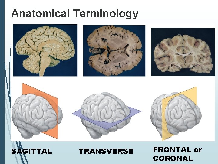 Anatomical Terminology SAGITTAL TRANSVERSE FRONTAL or CORONAL 