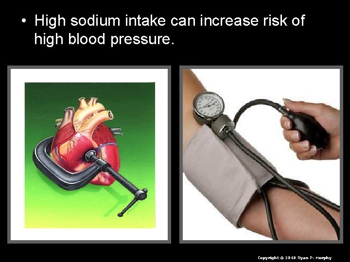  • High sodium intake can increase risk of high blood pressure. Copyright ©