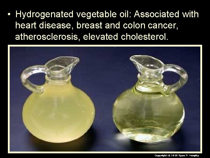  • Hydrogenated vegetable oil: Associated with heart disease, breast and colon cancer, atherosclerosis,