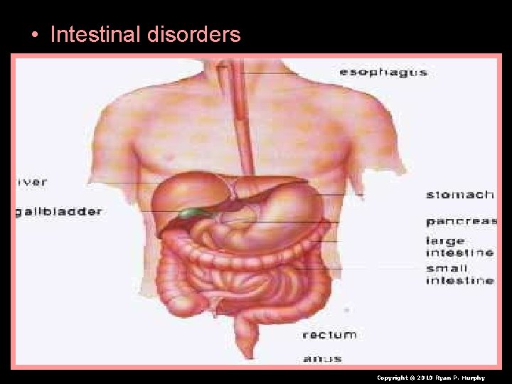  • Intestinal disorders Copyright © 2010 Ryan P. Murphy 