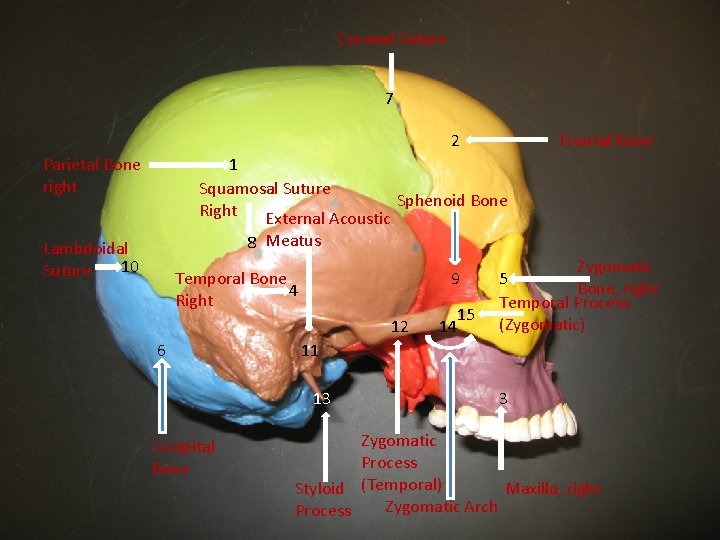 Coronal Suture 7 2 Parietal Bone right Frontal Bone 1 Squamosal Suture Sphenoid Bone