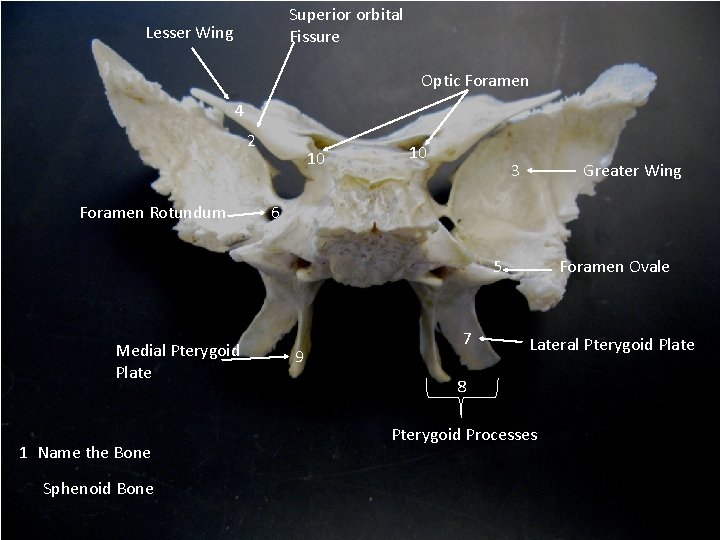 Superior orbital Fissure Lesser Wing Optic Foramen 4 2 Foramen Rotundum 10 10 3