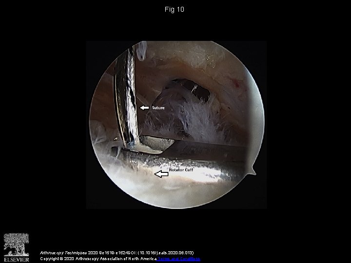 Fig 10 Arthroscopy Techniques 2020 9 e 1519 -e 1524 DOI: (10. 1016/j. eats.