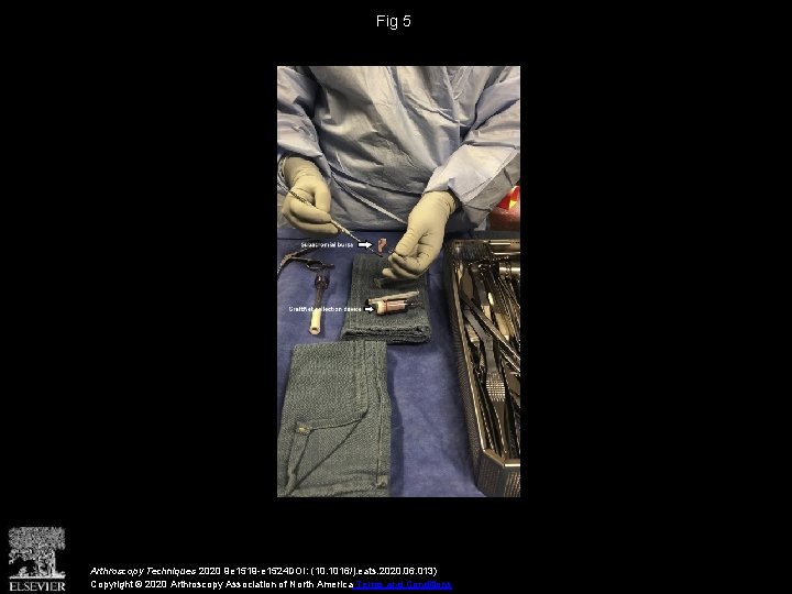 Fig 5 Arthroscopy Techniques 2020 9 e 1519 -e 1524 DOI: (10. 1016/j. eats.