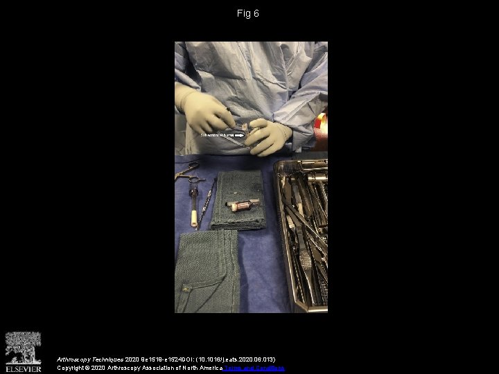 Fig 6 Arthroscopy Techniques 2020 9 e 1519 -e 1524 DOI: (10. 1016/j. eats.