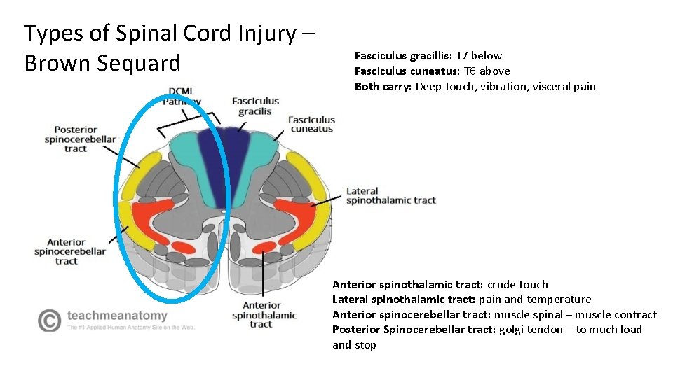 Types of Spinal Cord Injury – Brown Sequard Fasciculus gracillis: T 7 below Fasciculus