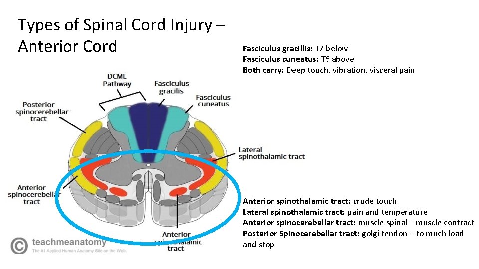 Types of Spinal Cord Injury – Anterior Cord Fasciculus gracillis: T 7 below Fasciculus