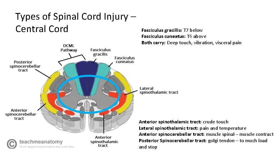 Types of Spinal Cord Injury – Central Cord Fasciculus gracillis: T 7 below Fasciculus