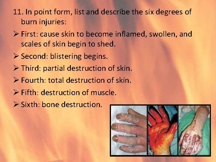 11. In point form, list and describe the six degrees of burn injuries: Ø