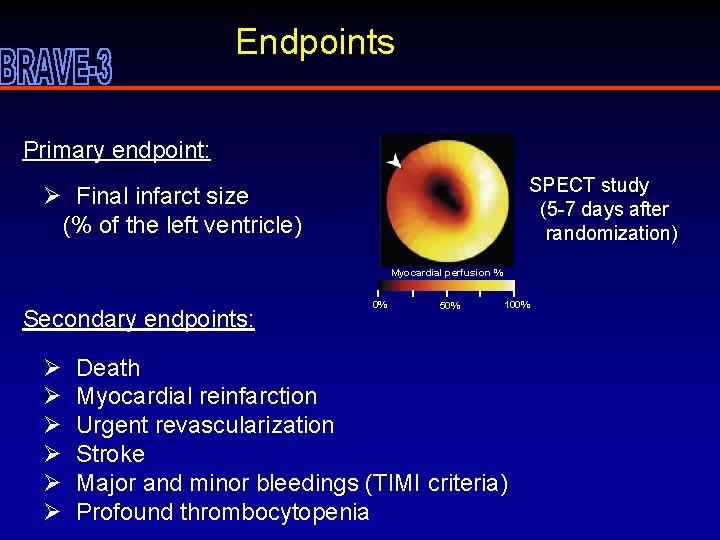 Endpoints Primary endpoint: SPECT study (5 -7 days after randomization) Ø Final infarct size