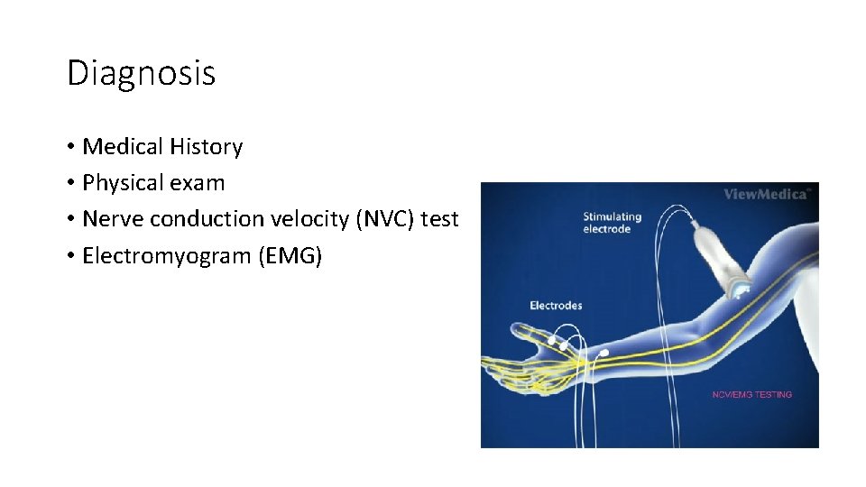Diagnosis • Medical History • Physical exam • Nerve conduction velocity (NVC) test •