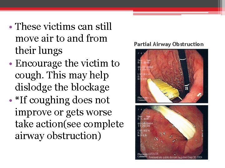  • These victims can still move air to and from their lungs •