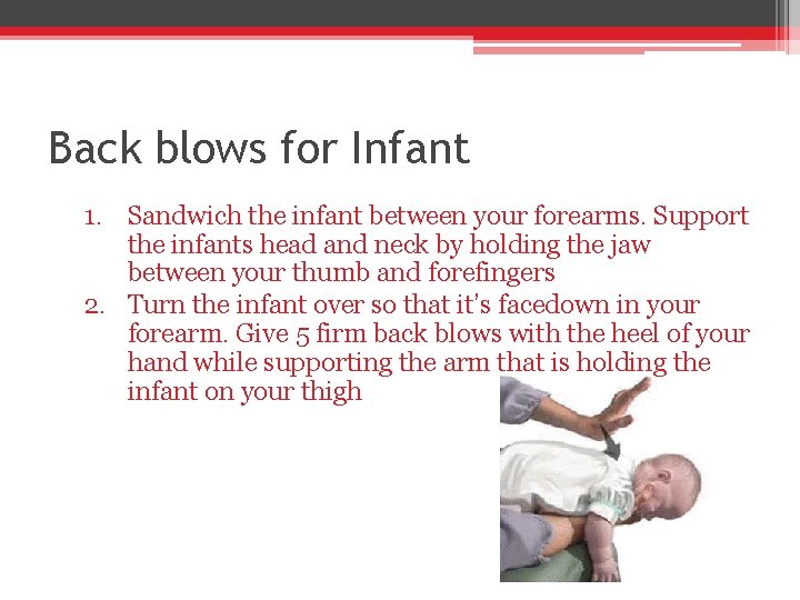 Back blows for Infant 1. Sandwich the infant between your forearms. Support the infants