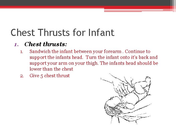 Chest Thrusts for Infant 1. Chest thrusts: 1. 2. Sandwich the infant between your