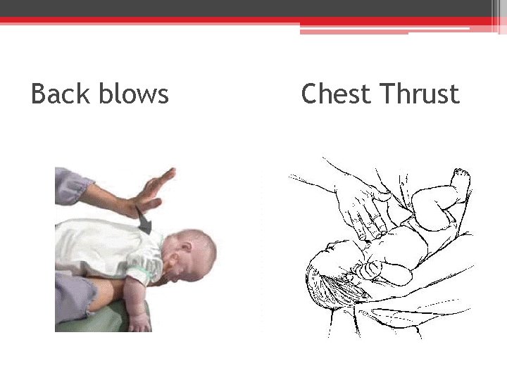 Back blows Chest Thrust 