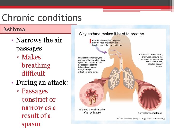 Chronic conditions Asthma • Narrows the air passages ▫ Makes breathing difficult • During