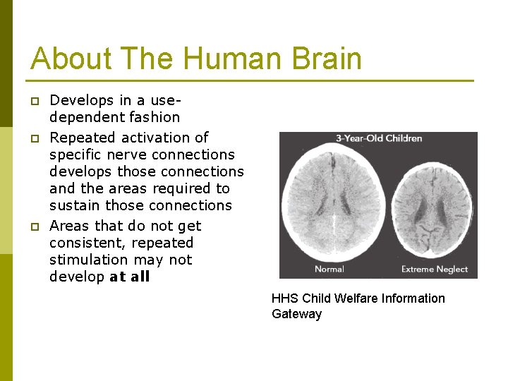 About The Human Brain p p p Develops in a usedependent fashion Repeated activation