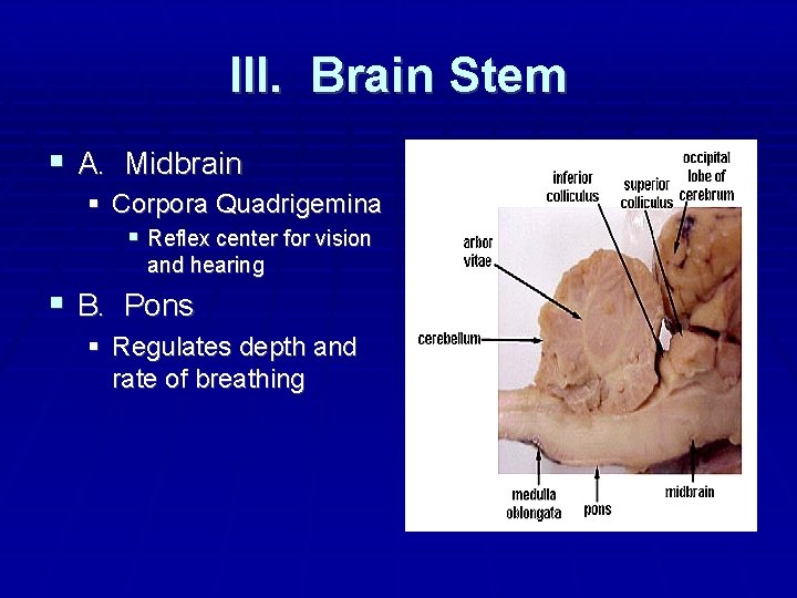 III. Brain Stem A. Midbrain Corpora Quadrigemina Reflex center for vision and hearing B.