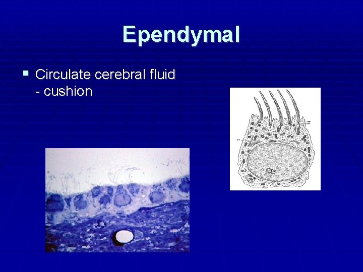 Ependymal Circulate cerebral fluid - cushion 