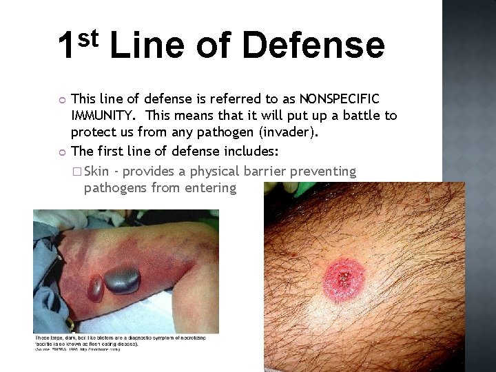 st 1 Line of Defense This line of defense is referred to as NONSPECIFIC
