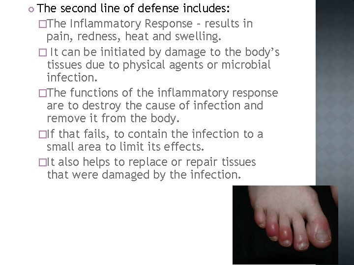  The second line of defense includes: �The Inflammatory Response – results in pain,