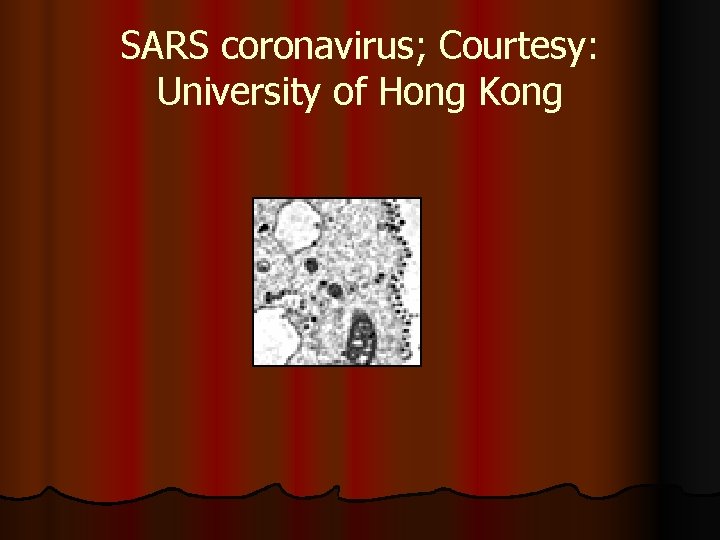 SARS coronavirus; Courtesy: University of Hong Kong 