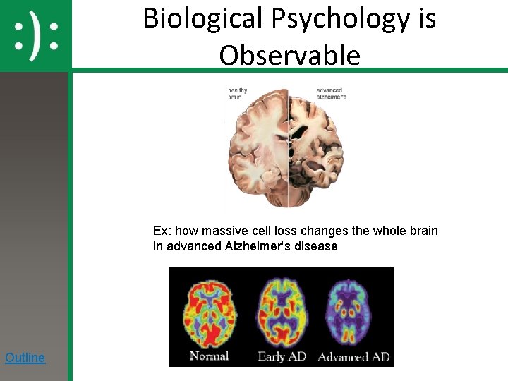 Biological Psychology is Observable Ex: how massive cell loss changes the whole brain in