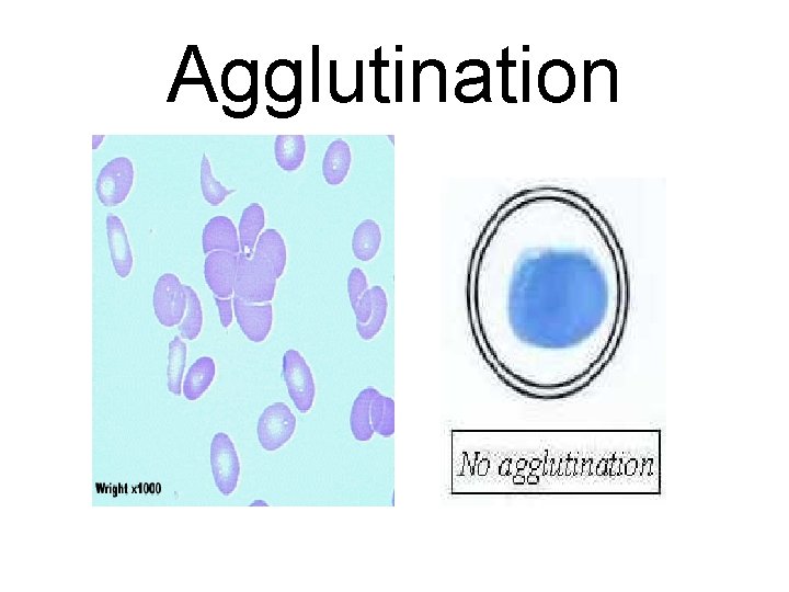 Agglutination 