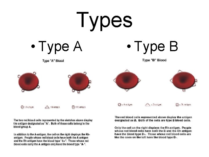 Types • Type A • Type B 