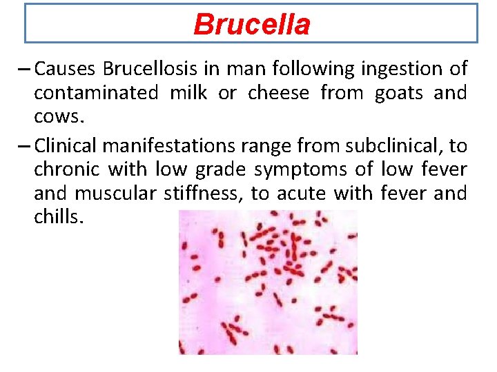 Brucella – Causes Brucellosis in man following ingestion of contaminated milk or cheese from