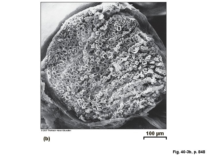 (b) 100 µm Fig. 40 -3 b, p. 848 