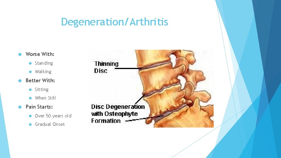 Degeneration/Arthritis Worse With: Standing Walking Better With: Sitting When Still Pain Starts: Over 50