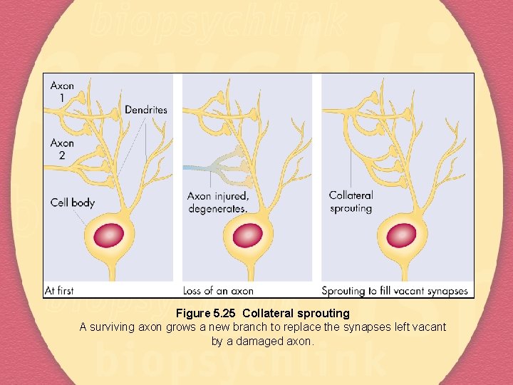 Figure 5. 25 Collateral sprouting A surviving axon grows a new branch to replace