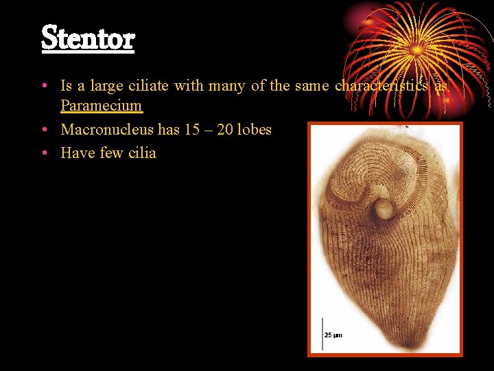 Stentor • Is a large ciliate with many of the same characteristics as Paramecium