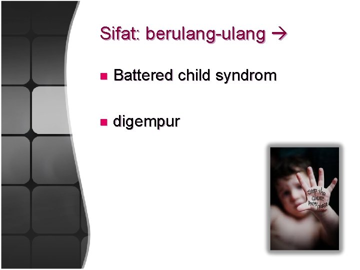 Sifat: berulang-ulang n Battered child syndrom n digempur 