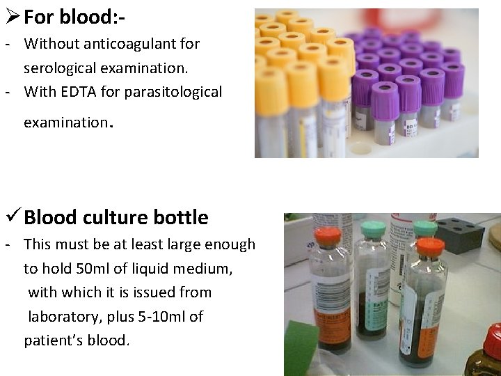 Ø For blood: - Without anticoagulant for serological examination. - With EDTA for parasitological