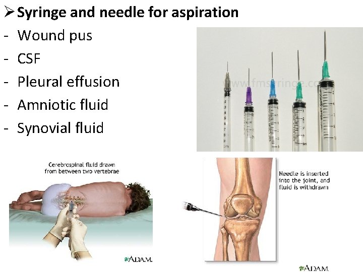 Ø Syringe and needle for aspiration - Wound pus - CSF - Pleural effusion