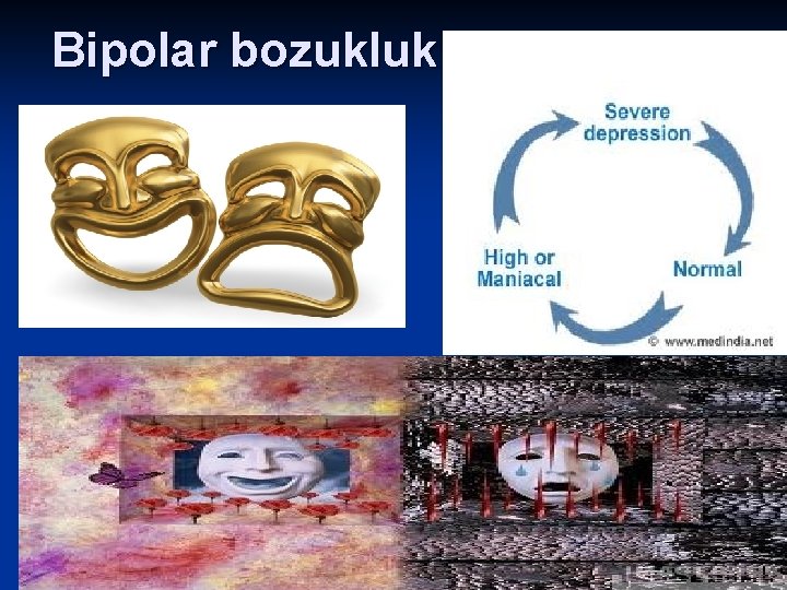 Bipolar bozukluk 