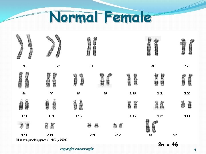 Normal Female copyright cmassengale 2 n = 46 4 