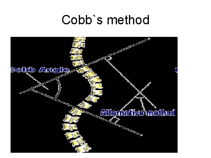 Cobb`s method 