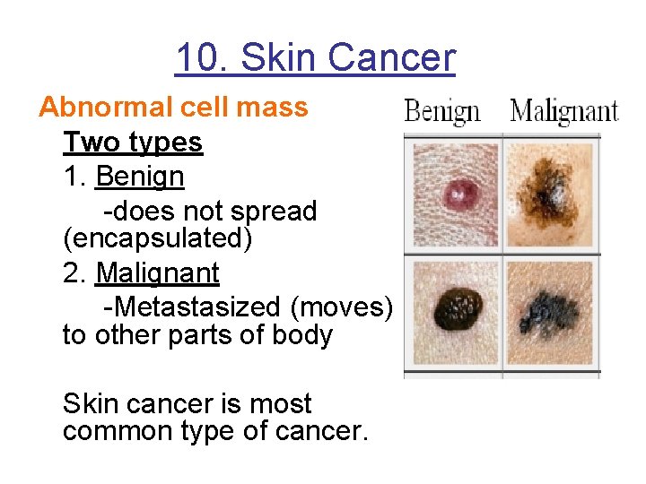 10. Skin Cancer Abnormal cell mass Two types 1. Benign -does not spread (encapsulated)